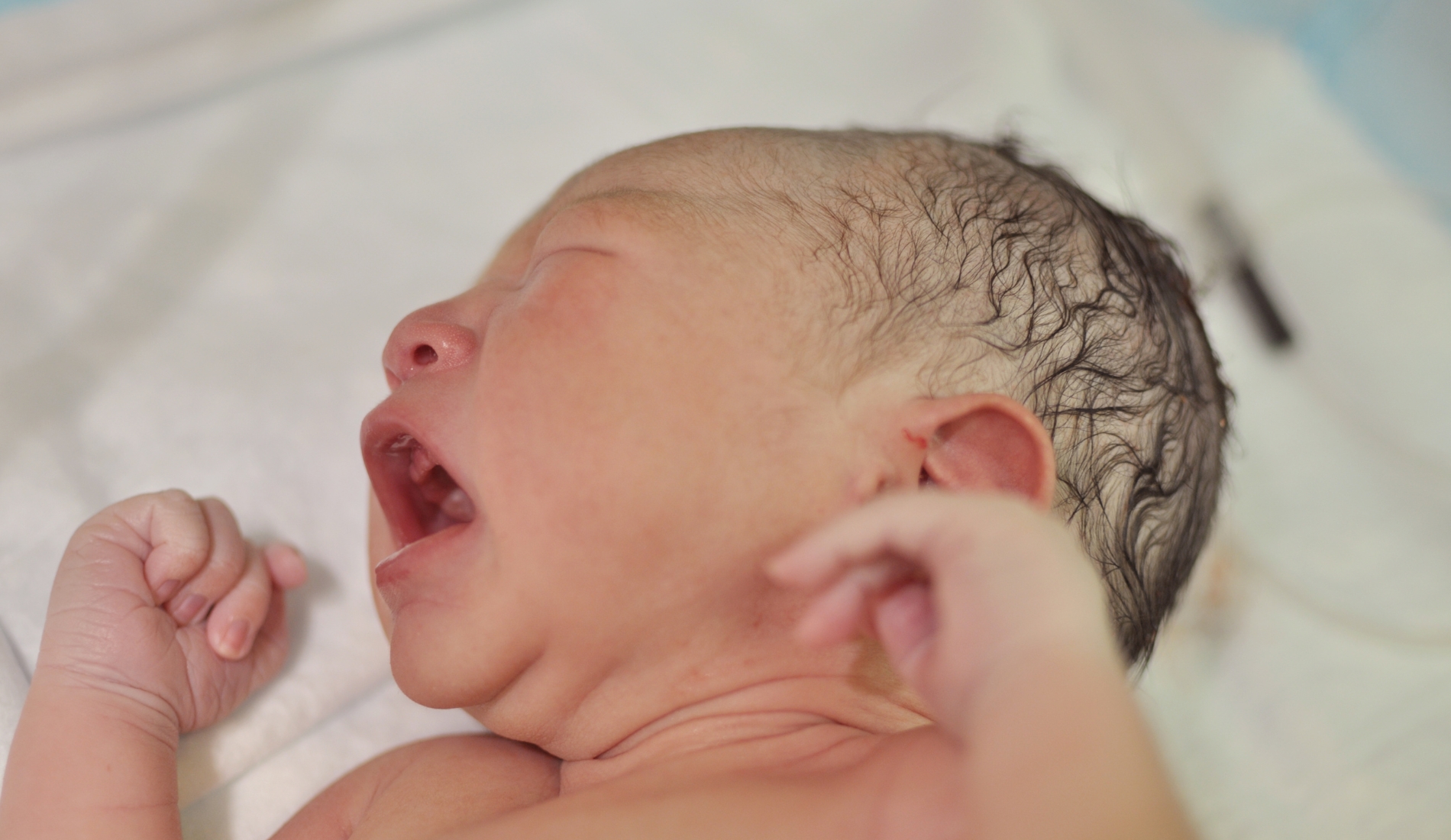 Natal Teeth in Newborns