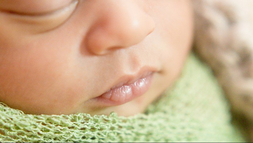 Newborn Lip Blister