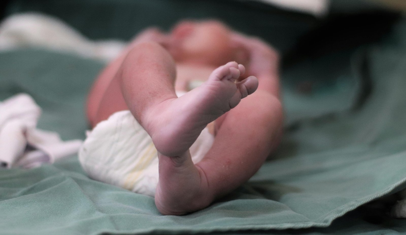 Staph Infection on Newborn