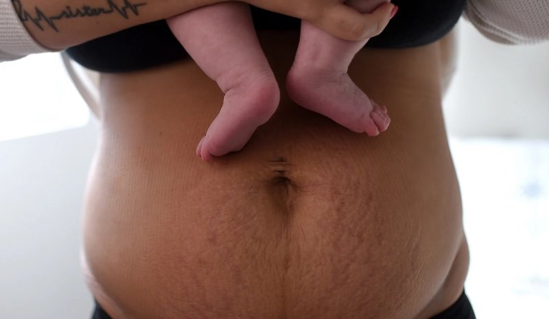 Postpartum Gassiness