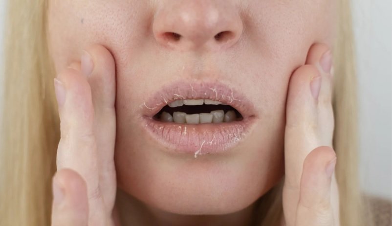 Postpartum Skin Dryness