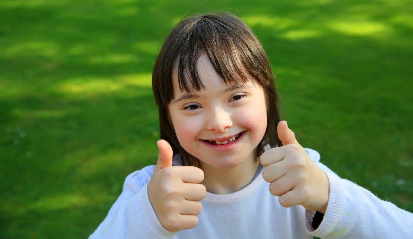 Down Syndrome Face Features