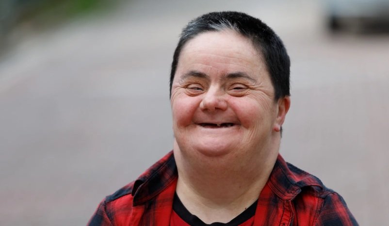 How Long Can a Person with Down Syndrome Live
