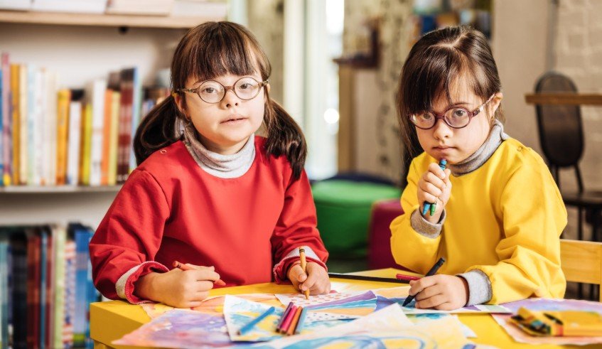Identical Twins with Down Syndrome