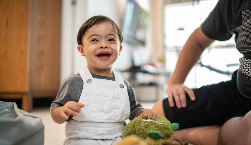 Newborn Down Syndrome Ears
