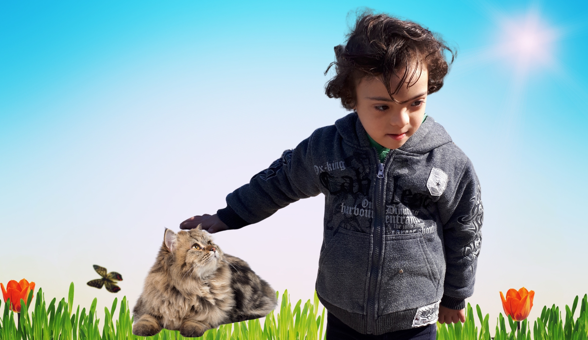 Signs of Down Syndrome in Newborn