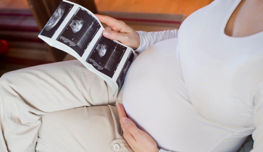 Heterotopic Pregnancy Hetero Ectopic Pregnancy