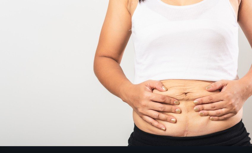 Loose Skin After Pregnancy