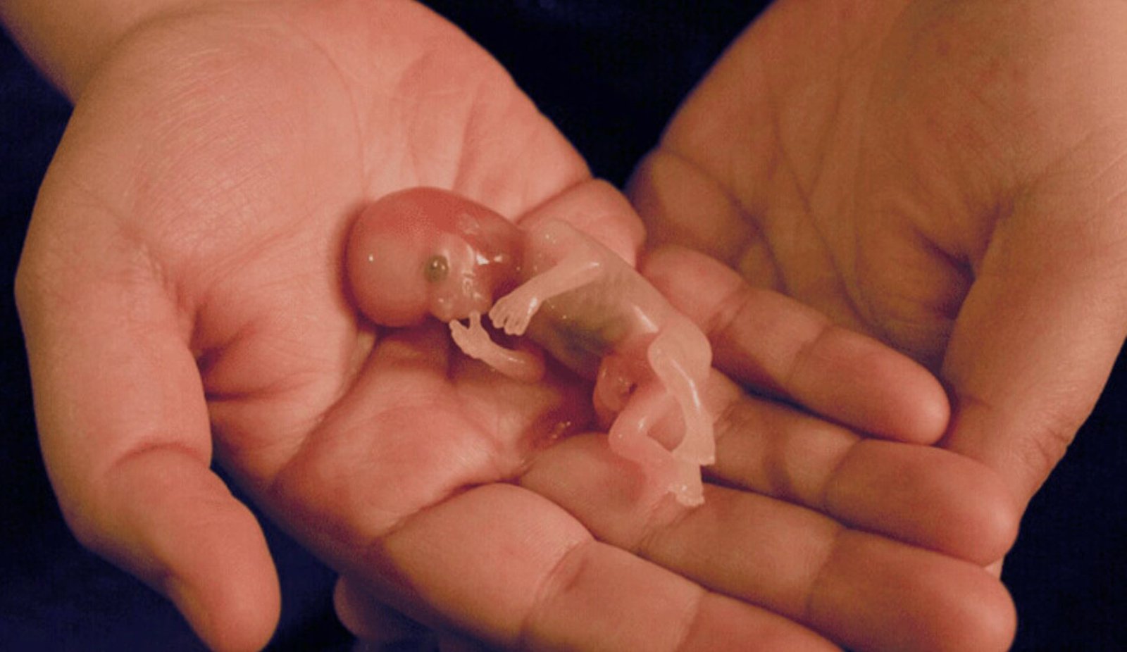 What to Do with Fetus After Miscarriage at Home