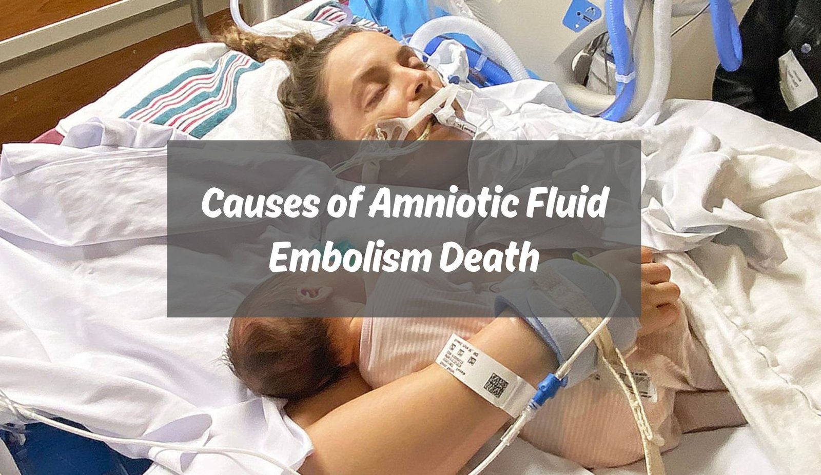Amniotic Fluid Embolism Death Amniotic Fluid Embolism Death Rate Death from Amniotic Fluid Embolism Is Most Commonly Due to