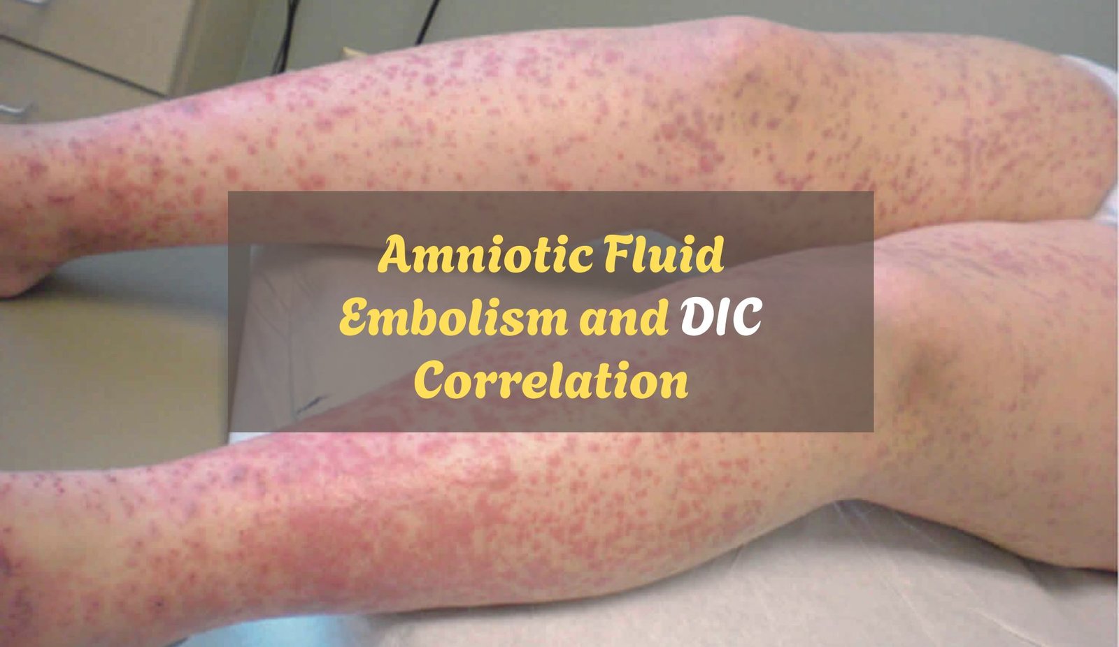 Amniotic Fluid Embolism and DIC
